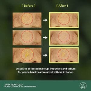 Huile Nettoyante ANUA Heartleaf