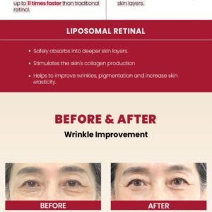 K-SECRET - SEOUL 1988 Cream : Retinal Liposome 1% + Fermented Rice 4 imgi 89 L g0212137117 003 K-SECRET SEOUL 1988 Cream