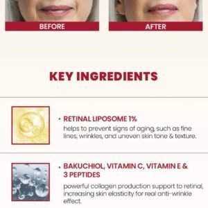 K-SECRET - SEOUL 1988 Cream : Retinal Liposome 1% + Fermented Rice 5 imgi 90 L g0212137117 004 K-SECRET SEOUL 1988 Cream