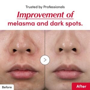 imgi 117 05 4f7ba18d d58f 4cb8 9390 466a48d9cc5b EQQUALBERRY DEEP CERA VITAMIN